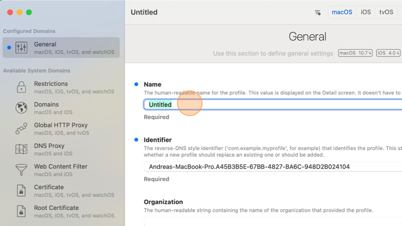 Screenshot of iMazing Profile Editor interface showing the name field.